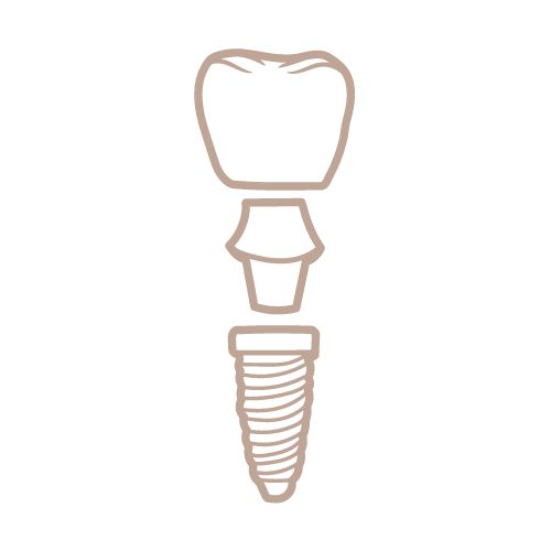 Imagen de un elemento usado para implantes dentales.